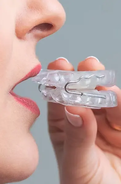 foto aparelho intraoral